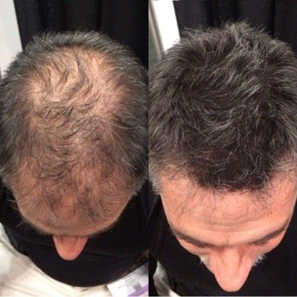 LUMIN - Hair Growth Serum Roll On